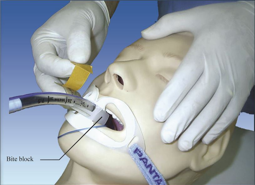 فیکساتور لوله تراشه 